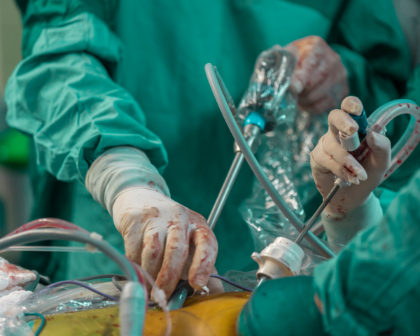 Cirugía laparoscópica Avanzada